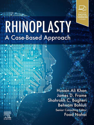 cover image of Rhinoplasty E-Book